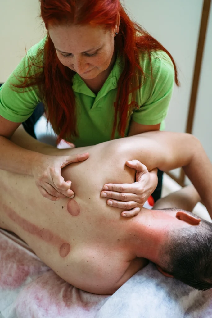 Praxis für Physiotherapie Maria Friebus - Manuelle Therapie - Schröpfen